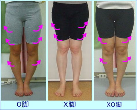 脚の形３パターン